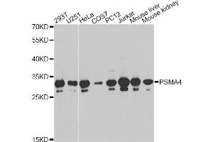 Western blot analysis of extracts of various cell lines, using PSMA4 antibody (ABIN6291447) at 1:1000 dilution. (PSMA4 antibody)