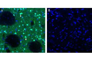 Free-floating frozen brain sections from a paraformaldehyde-perfused rat were incubated with Anti-Neurokinin 2 Receptor (NK2R) Antibody (ABIN7043806, 1:200), followed by goat anti-rabbit secondary antibody conjugated to Alexa Fluor® 488 (green).