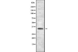 Western blot analysis of OR1J1 expression in HEK293 cells ,The lane on the left is treated with the antigen-specific peptide. (OR1J1 antibody)