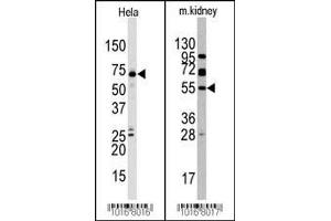 Western blot analysis of anti-JMJD4 (C-term) Pab in Hela and mouse kidney cell line lysate. (JMJD4 antibody  (C-Term))
