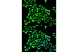 Immunofluorescence analysis of MCF-7 cells using CDA antibody. (CDA antibody  (AA 1-146))
