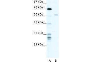 WB Suggested Anti-ZNFN1A4 Antibody Titration: 1.