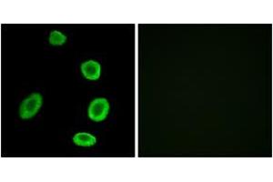 Immunofluorescence analysis of A549 cells, using OR8K1 Antibody.