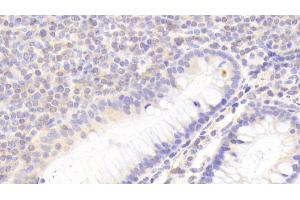 Detection of KLRC2 in Human Colon Tissue using Polyclonal Antibody to Killer Cell Lectin Like Receptor Subfamily C, Member 2 (KLRC2) (KLRC2 antibody  (AA 19-190))