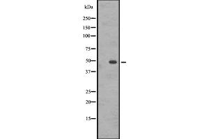 Western blot analysis of GASR expression in A431 whole cell lysate ,The lane on the left is treated with the antigen-specific peptide. (CCKBR antibody  (N-Term))
