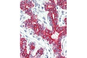Immunhistochemistry analysis in human breast tissue (Formalin-fixed, Paraffin-embedded) using Peroxin 7 / PEX7  (PEX7 antibody  (Internal Region))