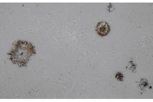 Immunohistochemistry (IHC) image for anti-Amyloid beta (Abeta) (AA 1-16), (N-Term) antibody (ABIN1105360) (beta Amyloid antibody  (N-Term))