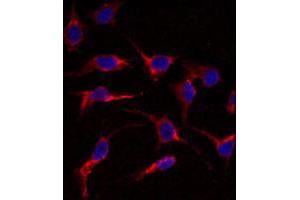 Immunofluorescence analysis of ERAS polyclonal antibody  in HeLa cells. (ERAS antibody  (N-Term))