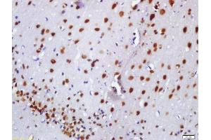 Formalin-fixed and paraffin embedded rat brain labeled with Anti-BASP1 Polyclonal Antibody, Unconjugated  at 1:200 followed by conjugation to the secondary antibody and DAB staining (BASP1 antibody  (AA 3-100))