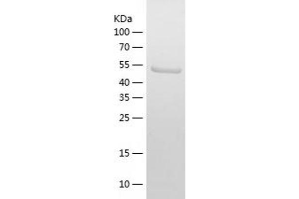 AIF Protein (AA 98-609) (His tag)