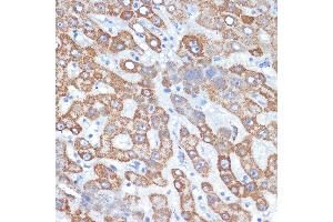 Immunohistochemistry of paraffin-embedded human liver using HMGCS2 Rabbit mAb (ABIN7265328) at dilution of 1:100 (40x lens). (HMGCS2 antibody)