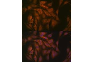 Immunofluorescence analysis of C6 cells using eIF3B Rabbit mAb (ABIN7267042) at dilution of 1:100 (40x lens). (EIF3B antibody)