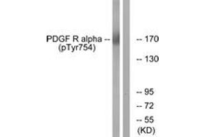 Western Blotting (WB) image for anti-Platelet Derived Growth Factor Receptor alpha (PDGFRA) (AA 721-770), (pTyr754) antibody (ABIN1531620) (PDGFRA antibody  (pTyr754))