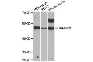 Western blot analysis of extracts of various cell lines, using CAMK2B antibody. (CAMK2B antibody  (AA 1-300))