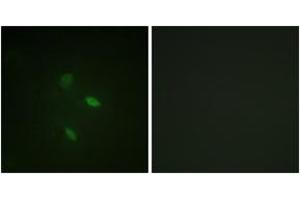 Immunofluorescence analysis of NIH-3T3 cells, using Cyclin E2 (Ab-392) Antibody. (Cyclin E2 antibody  (AA 355-404))
