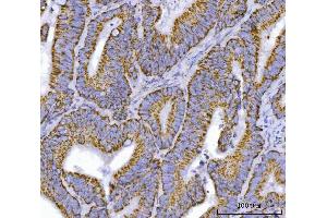 IHC analysis of TFEB using anti-TFEB antibody (ABIN7600648). (TFEB antibody  (AA 214-326))