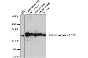Western blot analysis of extracts of various cell lines, using Carbonic Anhydrase 2 (C) Rabbit mAb (ABIN7266070) at 1:1000 dilution. (CA2 antibody)