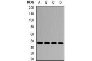 Western blot analysis of SKIP expression in mouse brain (A), rat brain (B) whole cell lysates. (SKIP antibody)