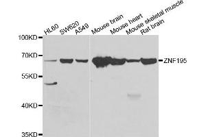 Western blot analysis of extracts of various cell lines, using ZNF195 antibody. (ZNF195 antibody)