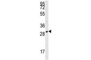 TPSAB1 antibody western blot analysis in 293 lysate. (TPSAB1 antibody  (AA 61-87))