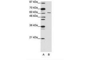 Image no. 2 for anti-CUGBP, Elav-Like Family Member 2 (CELF2) (AA 73-122) antibody (ABIN203186) (CELF2 antibody  (AA 73-122))