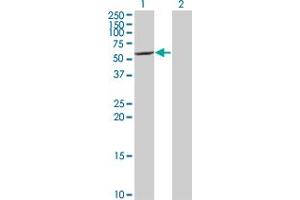 Western Blot analysis of CYP7B1 expression in transfected 293T cell line by CYP7B1 monoclonal antibody (M06), clone 2B11. (CYP7B1 antibody  (AA 203-286))