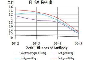 Black line: Control Antigen (100 ng), Purple line: Antigen(10 ng), Blue line: Antigen (50 ng), Red line: Antigen (100 ng), (SALL4 antibody  (AA 954-1053))