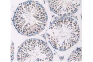 Detection of C1INH in Mouse Testis Tissue using Polyclonal Antibody to Complement 1 Inhibitor (C1INH) (SERPING1 antibody  (AA 397-495))