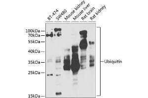 Western blot analysis of extracts of various cell lines, using Ubiquitin antibody (ABIN3022990, ABIN3022991, ABIN3022992 and ABIN6219334) at 1:1000 dilution. (Ubiquitin B antibody  (AA 1-76))