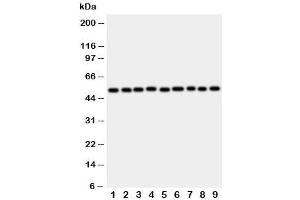 Western blot testing of E2F2 antibody and rat samples 1: lung (E2F2 antibody  (C-Term))