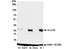 Western Blotting (WB) image for anti-HLA-DR (HLA-DR) antibody (ABIN7449537) (HLA-DR antibody)