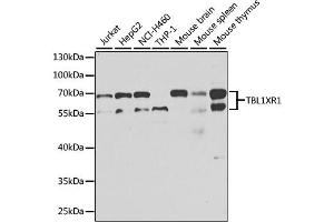 Western blot analysis of extracts of various cell lines, using TBL1XR1 antibody. (TBL1XR1 antibody)