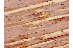 Immunohistochemistry analysis of human skeletal muscle tissue using ABIN7171966 at dilution of 1:100 (TAB3 antibody  (AA 361-712))