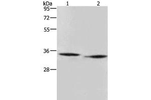 Western Blot analysis of Mouse heart and liver tissue using AMDHD2 Polyclonal Antibody at dilution of 1:500 (AMDHD2 antibody)
