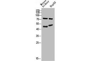 Western Blot analysis of mouse-kidney, hepg2 cells using Antibody diluted at 800. (Thymopoietin antibody  (AA 1-50))