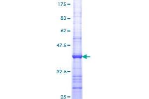 Image no. 1 for Enolase 1 (ENO1) (AA 325-434) protein (GST tag) (ABIN1352801) (ENO1 Protein (AA 325-434) (GST tag))