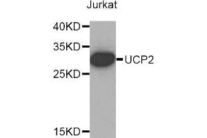 Western blot analysis of extracts of Jurkat cells, using UCP2 antibody. (UCP2 antibody)