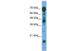 WB Suggested Anti-RAP1GAP Antibody Titration: 0. (RAP1GAP antibody  (Middle Region))
