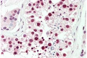 Human Testis: Formalin-Fixed, Paraffin-Embedded (FFPE) (DDX39 antibody  (AA 229-427))