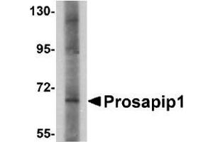 Western blot analysis of Prosapip1 in SK-N-SH cell lysate with AP30693PU-N Prosapip1 antibody at 1 µg/ml. (ProSAPiP1 antibody  (C-Term))
