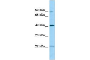WB Suggested Anti-CHID1 Antibody Titration: 1. (CHID1 antibody  (N-Term))