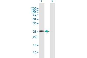 Western Blot analysis of SPR expression in transfected 293T cell line by SPR MaxPab polyclonal antibody. (SPR antibody  (AA 1-261))