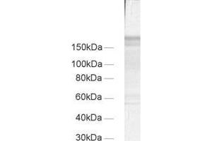 dilution: 1 : 100, sample: crude synaptic membranes fraction of rat brain (LP1) (Regulating Synaptic Membrane Exocytosis 1 (RIMS1) (AA 596-705) antibody)