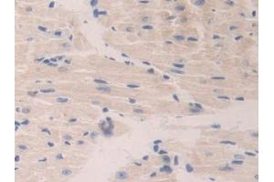 DAB staining on IHC-P; Samples: Mouse Heart Tissue (CTSA antibody  (AA 215-470))