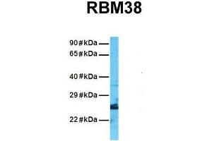 Host:  Rabbit  Target Name:  RBM38  Sample Tissue:  Human A549  Antibody Dilution:  1. (RBM38 antibody  (N-Term))