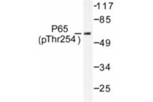 Image no. 1 for anti-Nuclear Factor-kB p65 (NFkBP65) (pThr254) antibody (ABIN318086) (NF-kB p65 antibody  (pThr254))