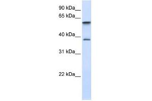 GIMAP5 antibody used at 1 ug/ml to detect target protein. (GIMAP5 antibody  (Middle Region))