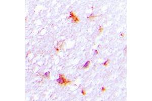 Immunohistochemical analysis of REG4 staining in human brain formalin fixed paraffin embedded tissue section. (REG4 antibody  (Center))