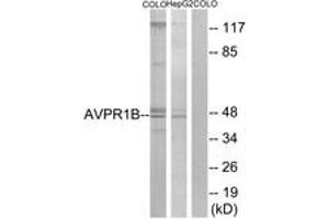 Western blot analysis of extracts from COLO/HepG2 cells, using AVPR1B Antibody.
