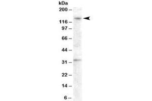 Western blot testing of human ovay lysate with GPR125 antibody at 0. (GPR125 antibody)